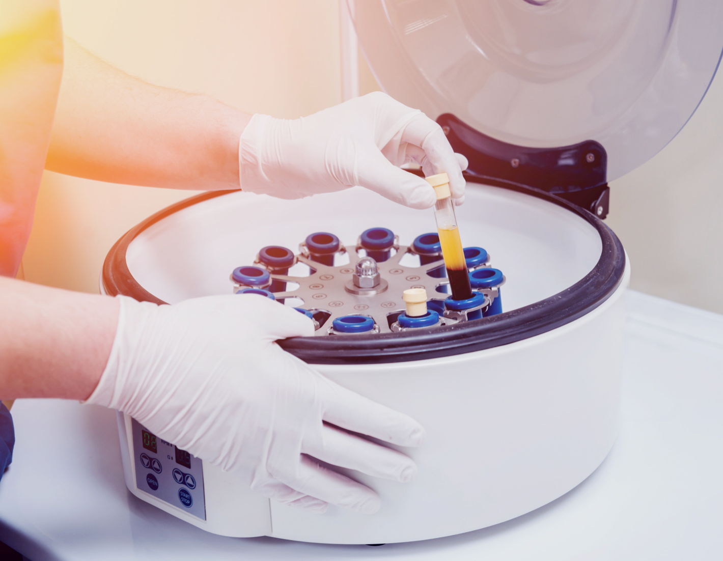 Плазмотерапия PRP